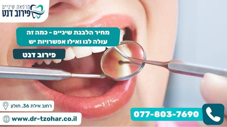 מחיר הלבנת שיניים - כמה זה עולה לנו ואילו אפשרויות יש