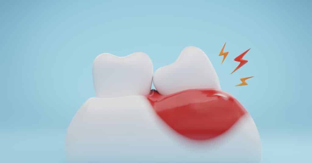 Periocenter