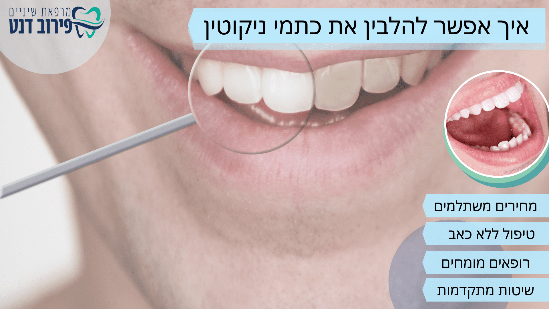 איך אפשר להלבין את כתמי ניקוטין