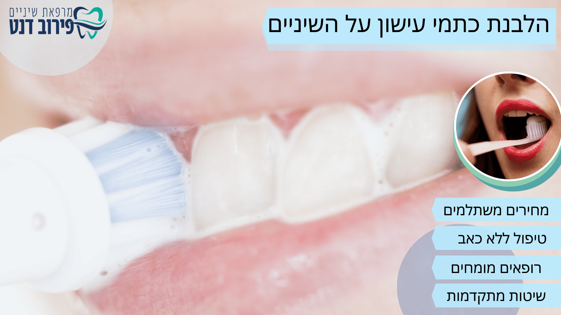 הלבנת כתמי עישון על השיניים