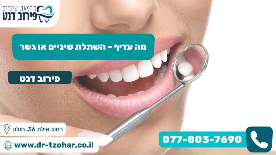 מה עדיף – השתלת שיניים או גשר