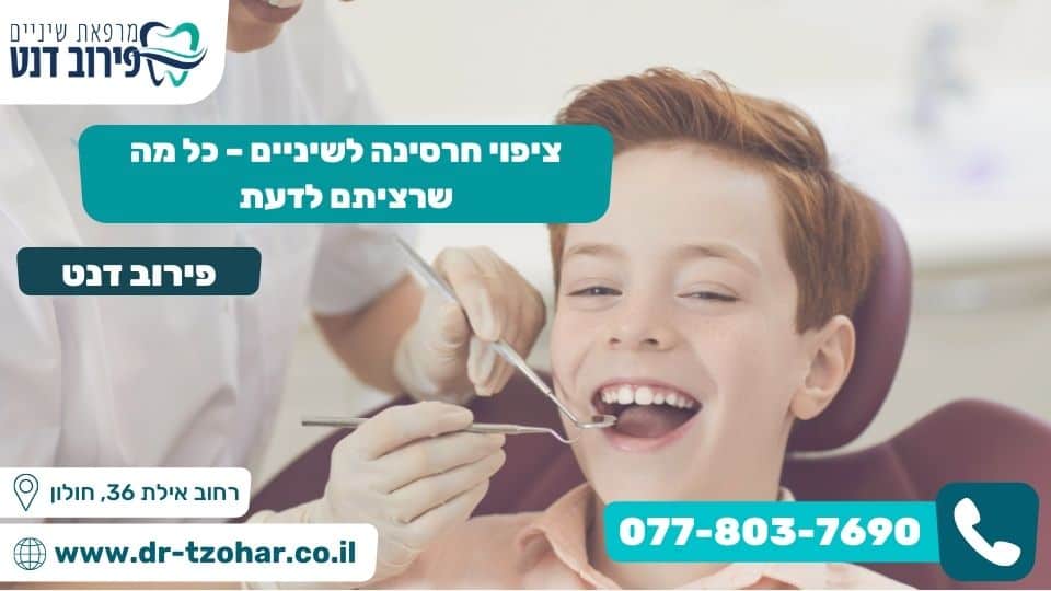 ציפוי חרסינה לשיניים – כל מה שרציתם לדעת