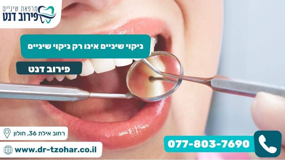 ניקוי שיניים אינו רק ניקוי שיניים