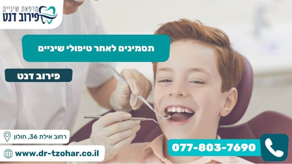 תסמינים לאחר טיפולי שיניים
