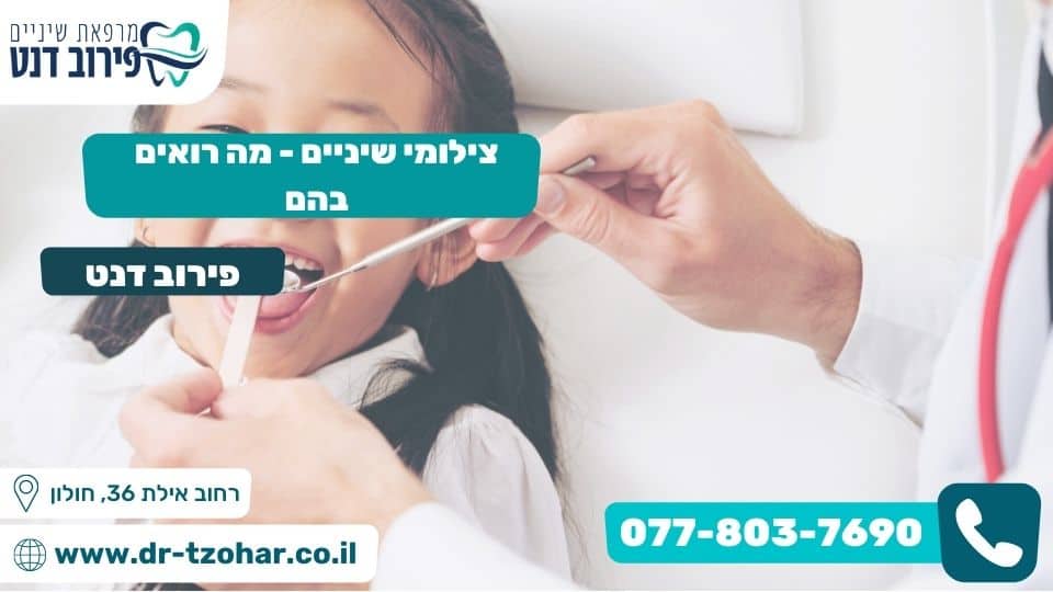 צילומי שיניים – מה רואים בהם