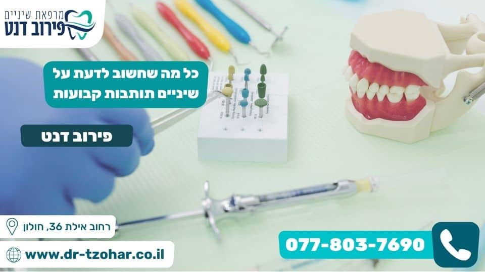 כל מה שחשוב לדעת על שיניים תותבות קבועות