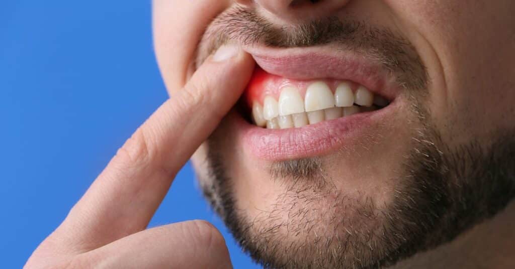 סובל ממחלת פה ושיניים אלו הזכויות שלך